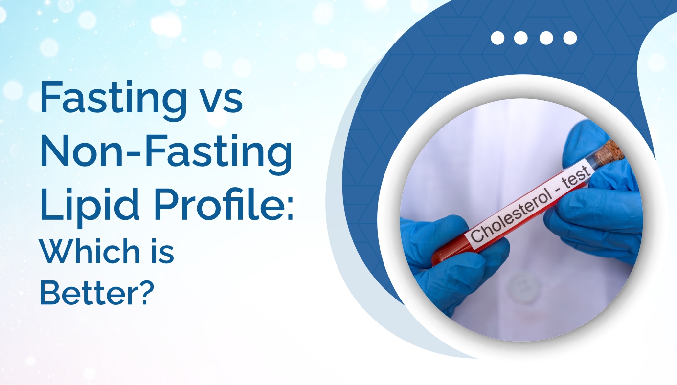 When Should You Get a Lipid Profile Test?